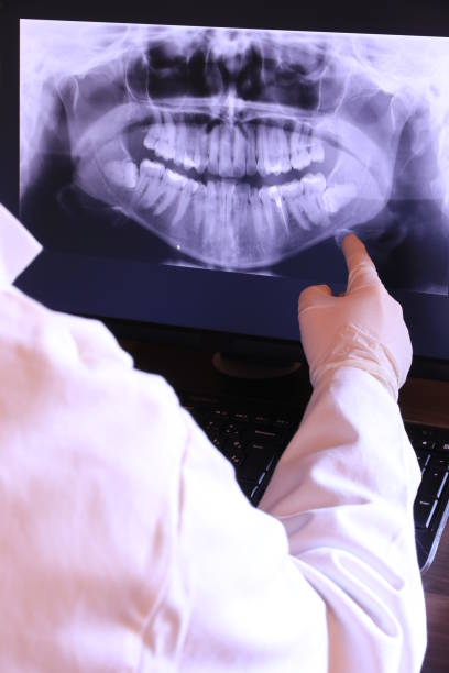 Best Broken or Chipped Tooth Repair in Vestavia Hills, AL